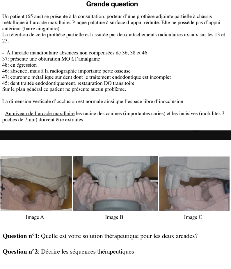 Prothèse